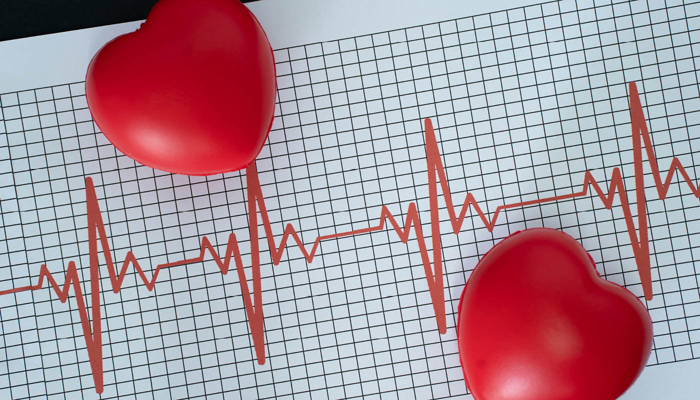 Tudo que você precisa saber sobre arritmia cardíaca - CCRMed Clínica de  Cardiologia e Reabilitação